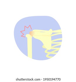 illustration of a shoulder bone. shoulder hinge pain. shoulder injury. flat style. vector illustration design