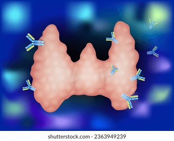 Illustration Showing Antibodies Attacking Thyroid Gland. Autoimmune Thyroiditis, Hashimoto`s Disease. Autoimmunity
