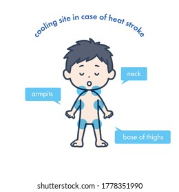 It is an illustration showing the cooling site when there is a suspicion of heat stroke. Vector image.