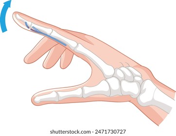 Illustration showing finger flexion mechanism