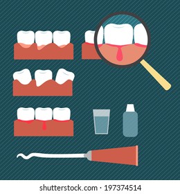 Illustration showing gum disease in a flat style of minimalism 
