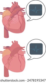 Illustration showing the heart moving on an electrocardiogram monitor