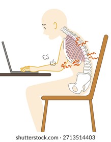 Una ilustración que muestra cómo la mala postura causada por el trabajo de escritorio ejerce presión sobre los pulmones