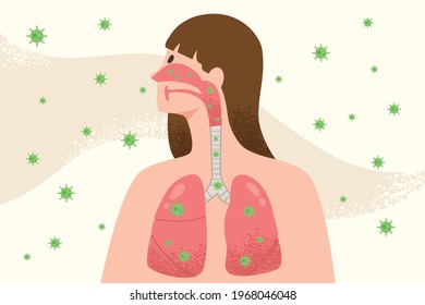 Illustration Showing How Virus Go Into Lungs. Concept Of COVID-19 Infection, The Lungs Affected By A Coronavirus, Pneumonia Lung Disease, Medical Illustration, Health Care Education. Flat Vector.