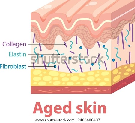 Illustration showing layers and components of aged skin