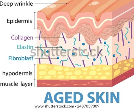 Illustration showing layers and components of aged skin