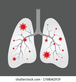 Illustration showing lungs infected by corona virus