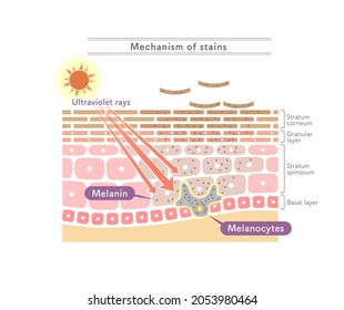 Illustration showing the mechanism of stains.English notation.