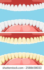 Illustration showing teeth health and plaque buildup