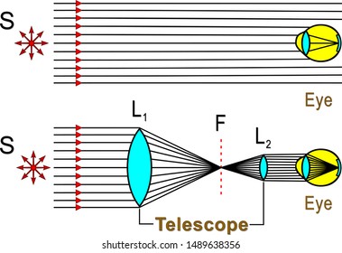 The illustration shows how the Telescope increases amount of light entering the eye.