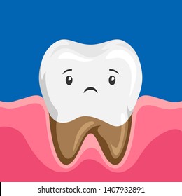 Illustration of sick tooth with caries. Children dentistry sad character. Kawaii facial expression.