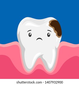 Illustration of sick tooth with caries. Children dentistry sad character. Kawaii facial expression.