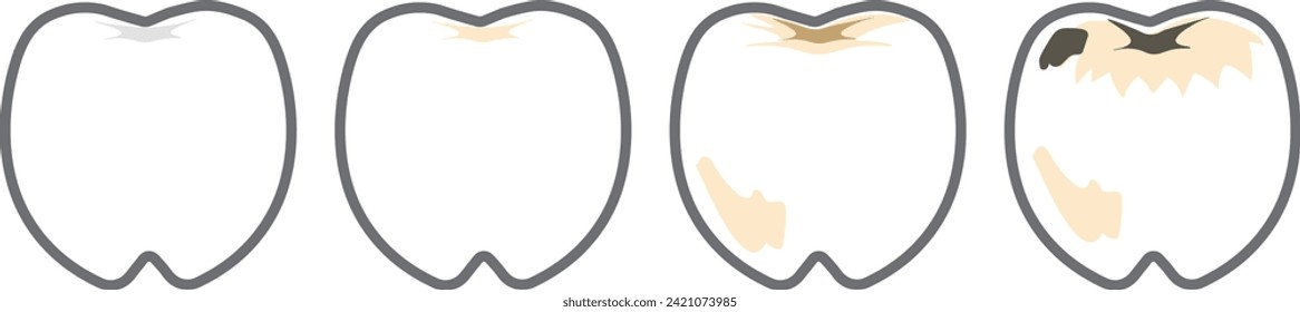 Illustration of simple and cute teeth and cavities