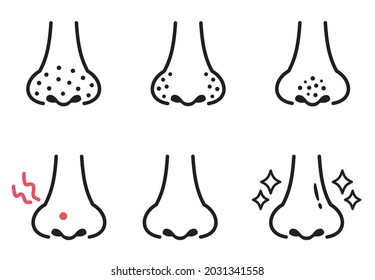 Illustration of a simple line drawing of a nose stain