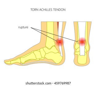 Illustration Skeletal Ankle Side View Back Stock Vector (Royalty Free ...