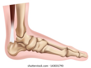 Illustration Of The Skeletal Foot