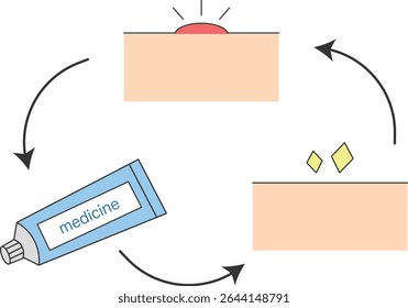 Ilustração do Ciclo de Cura de Problemas da Pele com Medicação Tópica