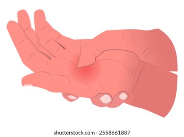 illustration of a sore palm, suitable for medical professionals, or designers who create content related to health, physical therapy, or injury prevention