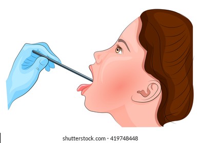 illustration of sore throat. inspection of the throat. angina