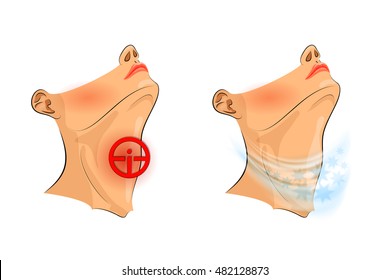 illustration of sore throat. sore throat, pain relief

