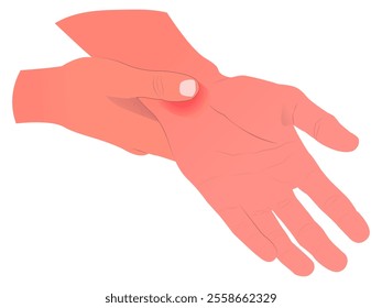 illustration of a sore wrist, suitable for medical professionals, or designers. suitable for use in brochures, infographics, websites, or social media posts.