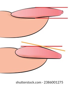 Ilustración de las etapas de formación de una placa de uñas de manicura para la formación en extensiones de vectores