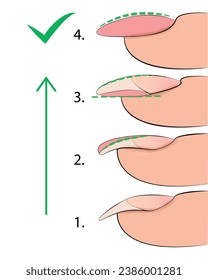 Ilustración de las etapas de formación de una placa de uñas de manicura para la formación en extensiones de vectores