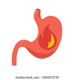 Illustration Of Stomach Burning Sensation