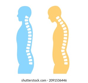 Illustration of straight neck and cervical spine