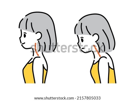 Illustration of a straight neck and a normal neck.