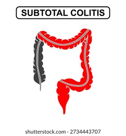 Illustration of subtotal colitis, ulcerative colitis. Inflammation of the human digestive system. Inflammatory bowel disease, Inflammation of the human digestive system. Vector drawing illustration for medical