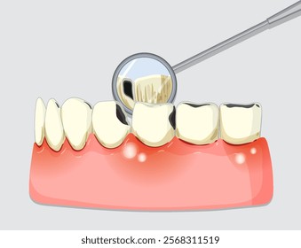 Illustration of teeth and dental examination tool