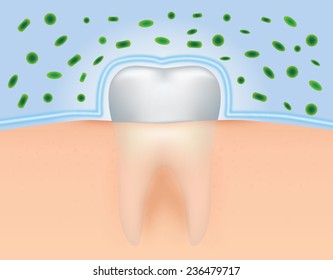 Illustration of teeth to get protection from bacteria.