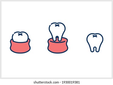 Illustration of the teeth and gums of simple design