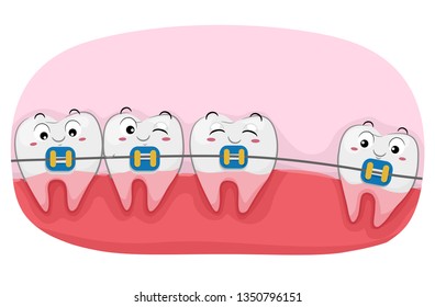 Illustration of Teeth Mascots with Big Space in Between Wearing Braces