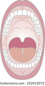 Illustration of teeth with mouth fully open