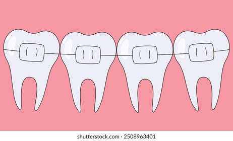 ilustração de uma linha de dentes com chaves em fundo rosa.