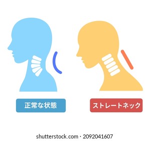 Illustration of text neck and cervical spine Translation;Text neck and normal neck