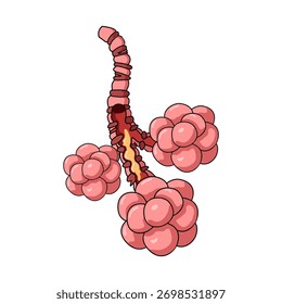 Abbildung dicken Schleims in der Lunge, Bronchitis, Asthmaanfall, Kurzatmigkeit. Entzündung der Bronchialröhrchen. Vektorgrafik für Medizin, Gesundheit und Kliniken.