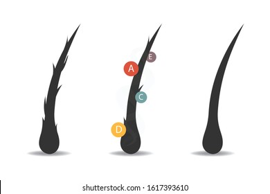 Illustration of three phase of hair cure, vector