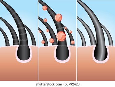 Illustration of three phase of hair cure, vector