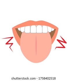 Illustration of tongue symptoms and health