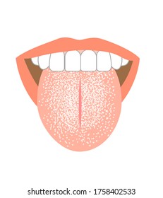 Illustration of tongue symptoms and health