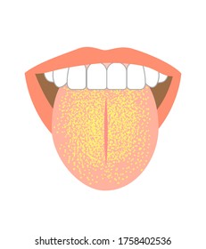 Illustration of tongue symptoms and health