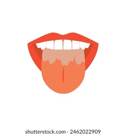 Illustration of tongue symptoms and health