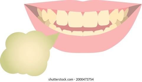 Ilustración de coloración dental y mal aliento.