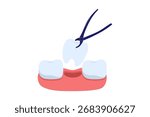 Illustration of Tooth Extraction Procedure. Forceps Removing a Tooth, a Concept of Dental Surgery and Oral Treatment
