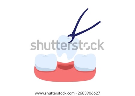 Illustration of Tooth Extraction Procedure. Forceps Removing a Tooth, a Concept of Dental Surgery and Oral Treatment