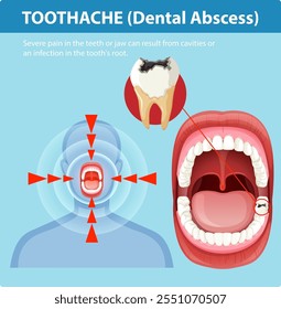 Illustration of tooth pain and dental abscess