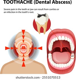 Ilustração das causas e sintomas da dor de dente